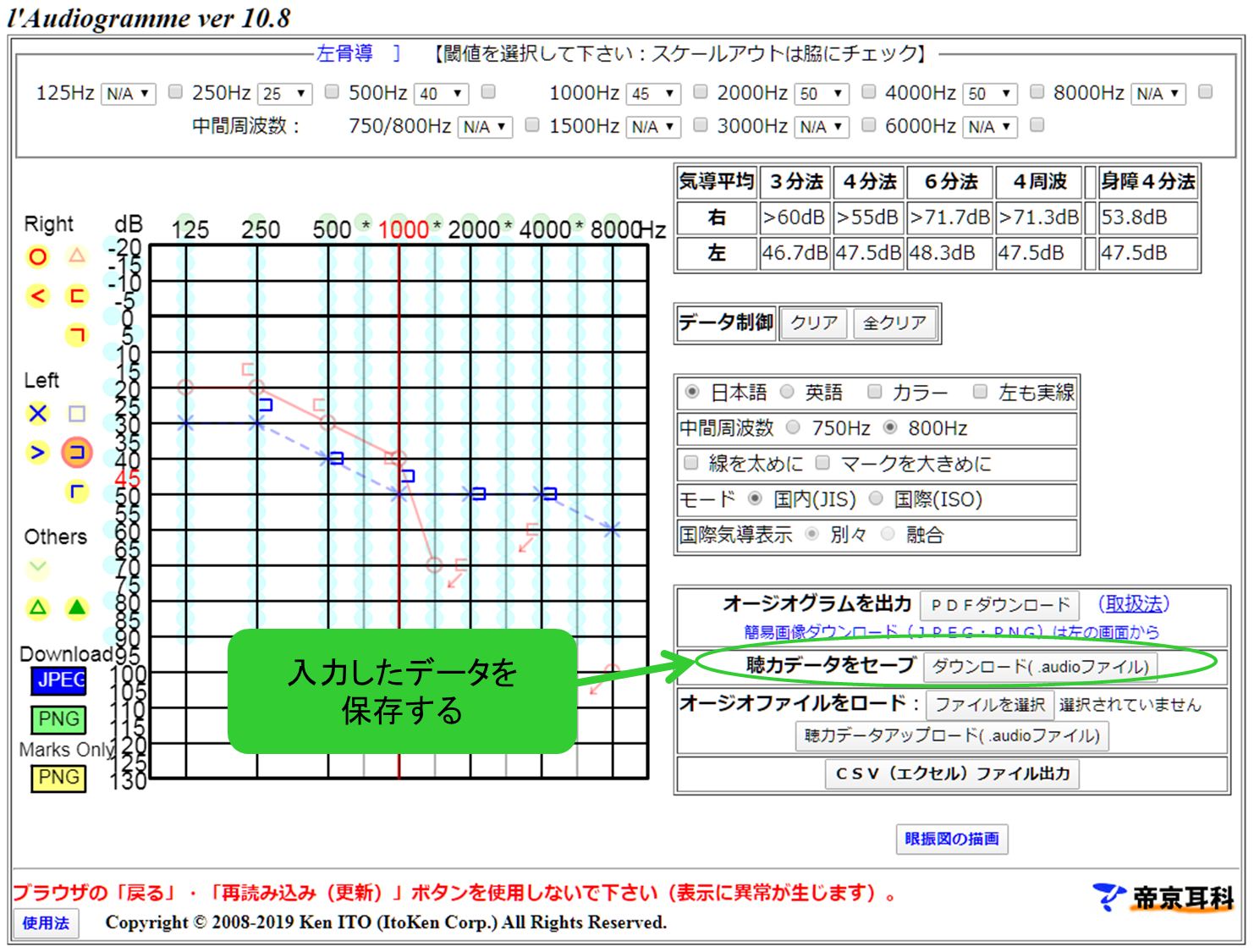 聴力検査の結果をスマホやパソコンで作成 管理する方法 簡単 便利 きこえライフ