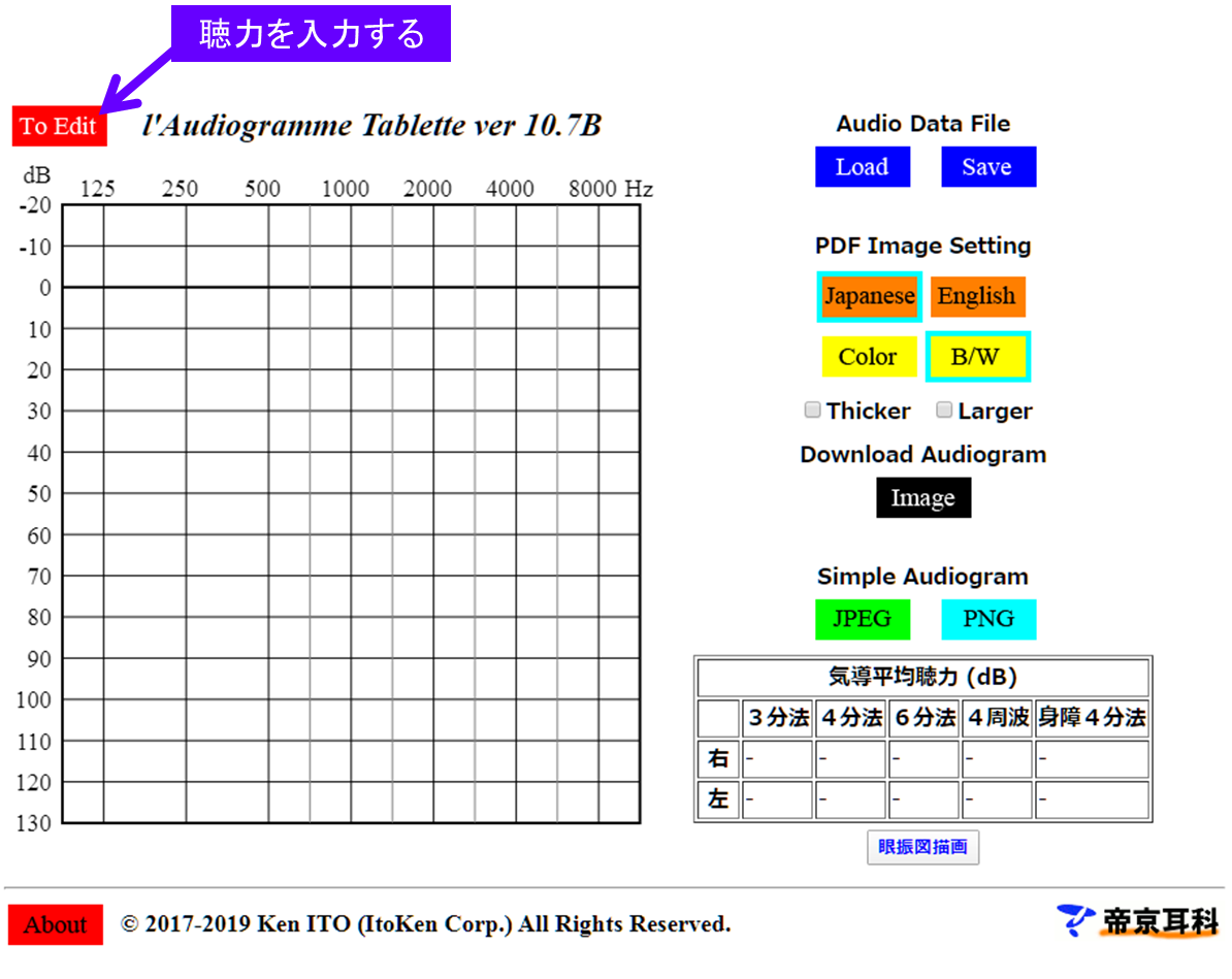 聴力検査の結果をスマホやパソコンで作成 管理する方法 簡単 便利 きこえライフ