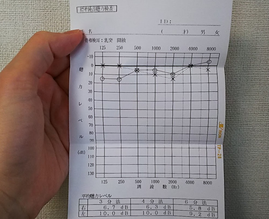 聴力検査の結果をスマホやパソコンで作成 管理する方法 簡単 便利 きこえライフ