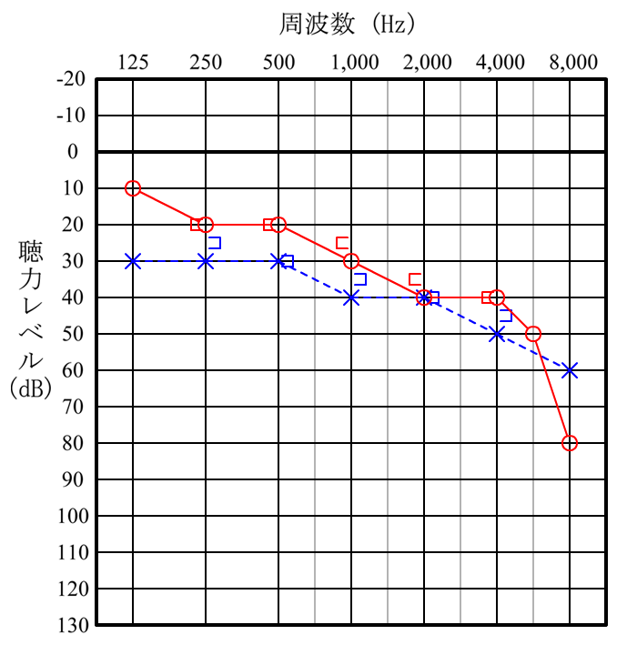 聴力検査の結果をスマホやパソコンで作成 管理する方法 簡単 便利 きこえライフ