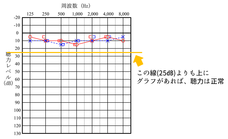 聴力検査の結果からわかること 見方を理解しよう きこえライフ