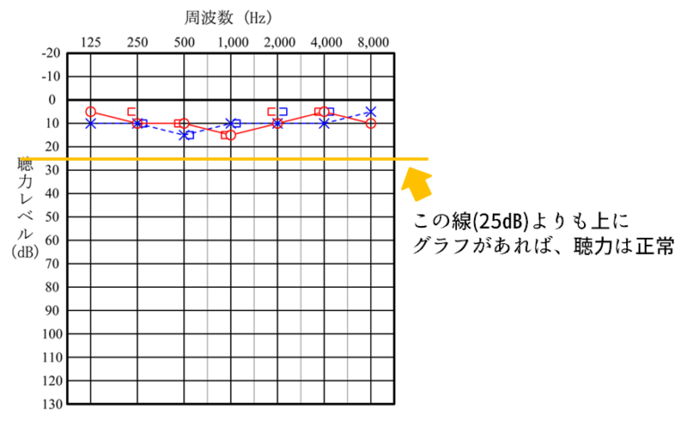 聴覚の健康: 聴力測定の重要性を理解する