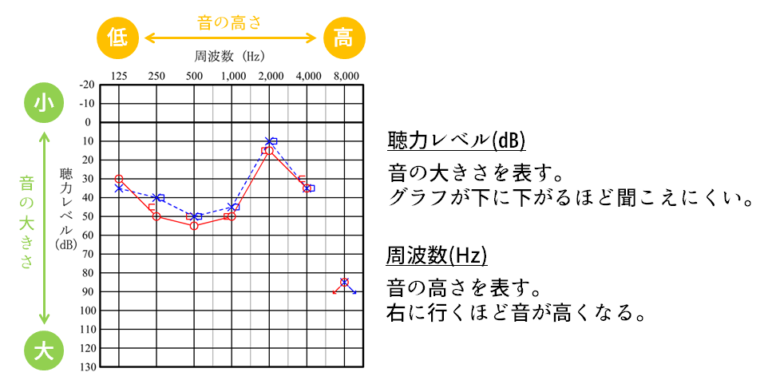 聴覚の健康: 聴力測定の重要性を理解する